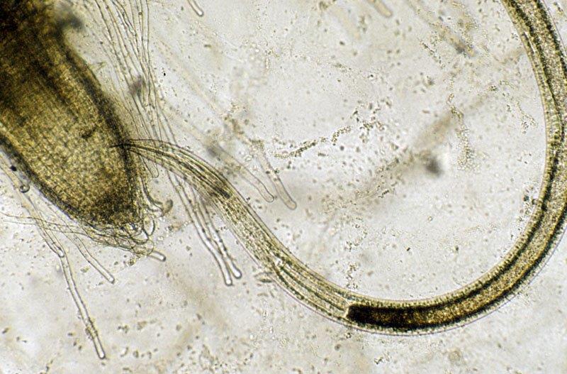 Virus-vector nematodes from soil: Needle and Dagger nematodes